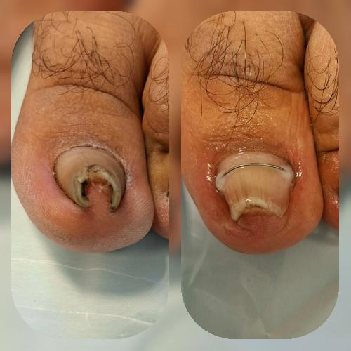 درمانی در تبریز