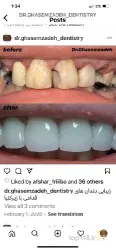 نمونه کار مطب دندانپزشکی دکتر وحید قاسم زاده در تبریز - 3