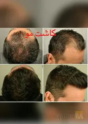 نمونه کار مطب دکتر یوسف نایب زاده  در تبریز - 3