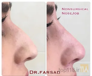 نمونه کار مطب دکتر مرتضی فرساد در تبریز - 3