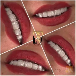 نمونه کار دندانپزشکی  دکتر سید  ابراهیم تقوی در تبریز - 3