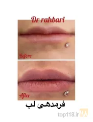 نمونه کار زیبایی و پوست و مو دکتر رسول رهبری در تبریز - 3