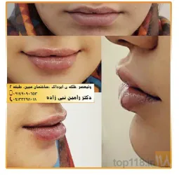 نمونه کار مطب دکتر رامین نبی زاده در تبریز - 3