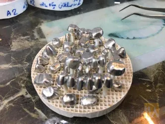 نمونه کار لابراتوار پروتزهای دندانی تراب زارع در قزوین - 3