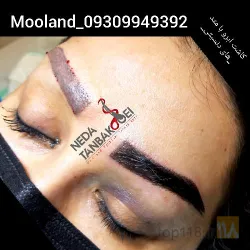 نمونه کار کاشت ابرو مولند در اصفهان - 2