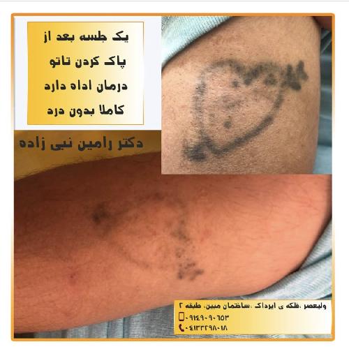 مطب دکتر رامین نبی زاده در تبریز خدمات پوست و مو و زیبایی و لیزر در تبریز