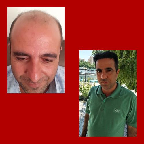 پوست و مو و زیبایی در تبریز