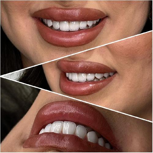 دندانپزشکی در تبریز