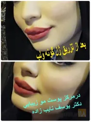 نمونه کار مطب دکتر یوسف نایب زاده  در تبریز - 4