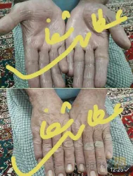 نمونه کار عطاری شفا  در تبریز - 4