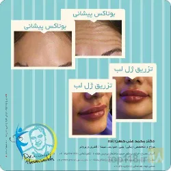 نمونه کار مطب پزشکی زیبایی دکتر حسن زاده  در تبریز - 4