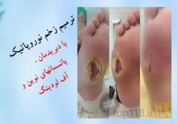 نمونه کار مرکز  زخم دکتر قادری تبریز در تبریز - 4