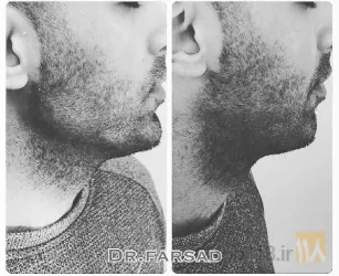 نمونه کار مطب دکتر مرتضی فرساد در تبریز - 4