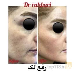 نمونه کار زیبایی و پوست و مو دکتر رسول رهبری در تبریز - 4