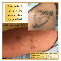 نمونه کار مطب دکتر رامین نبی زاده در تبریز - 4