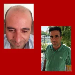 نمونه کار کلینیک تخصصی پوست و مو یاقوت در تبریز - 4