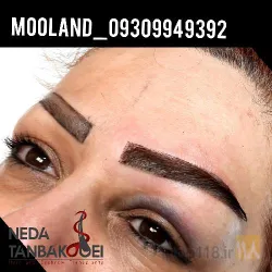 نمونه کار کاشت ابرو مولند در اصفهان - 3