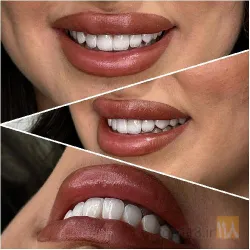 نمونه کار کلینیک  تخصصی دندانپزشکی مروارید در تبریز - 4