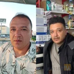 نمونه کار  کاشت مو ایمانی در تبریز - 3