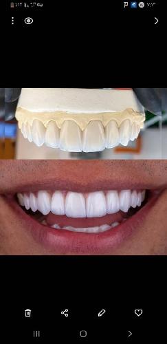 ارائه خدمات دندانپزشکی  در تبریز