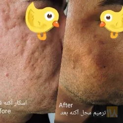 نمونه کار مطب پوست و مو دکتر صلح جو در تبریز - 5
