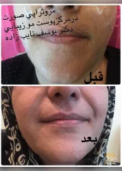 نمونه کار مطب دکتر یوسف نایب زاده  در تبریز - 5