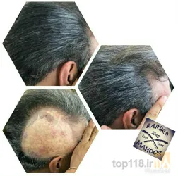 نمونه کار سالن آرایش ماهور  در تبریز - 5
