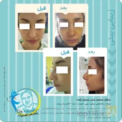 نمونه کار مطب پزشکی زیبایی دکتر حسن زاده  در تبریز - 5