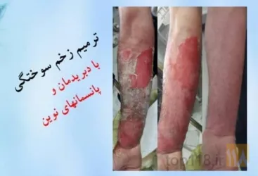 نمونه کار مرکز  زخم دکتر قادری تبریز در تبریز - 5