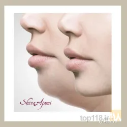 نمونه کار مطب دکتر شیوا عجمی (سلامت و زیبایی آبرسان ) در تبریز - 5