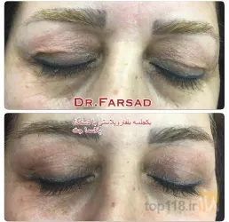 نمونه کار مطب دکتر مرتضی فرساد در تبریز - 5