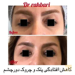 نمونه کار زیبایی و پوست و مو دکتر رسول رهبری در تبریز - 5