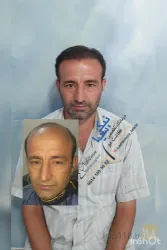 نمونه کار تیم کاشت موی رحیمی در تبریز - 5