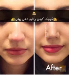 نمونه کار مطب پوست و زیبایی دکتر میترا احمدی در تبریز - 5