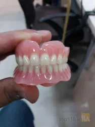 نمونه کار لابراتوار پروتزهای دندانی تراب زارع در قزوین - 5