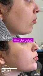 نمونه کار پوست و مو و لیزر الیزه در تبریز - 5