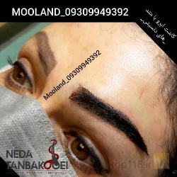 نمونه کار کاشت ابرو مولند در اصفهان - 4