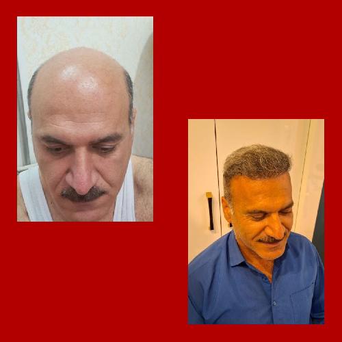 پوست و مو و زیبایی در تبریز