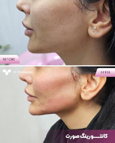 مطب پوست و مووزیبایی در تبریز