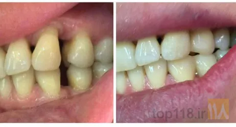 نمونه کار مطب دندانپزشکی دکتر وحید قاسم زاده در تبریز - 6