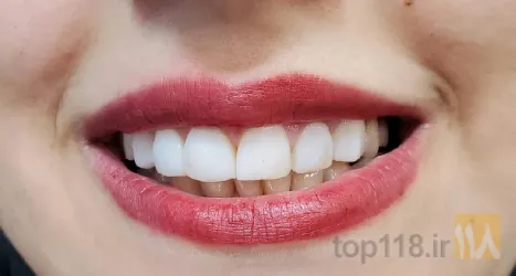 نمونه کار مطب دندانپزشکی  در تبریز - 6