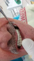 نمونه کار دندانپزشکی دکترمحمدرضا پرورش  در تبریز - 6