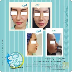 نمونه کار مطب پزشکی زیبایی دکتر حسن زاده  در تبریز - 6