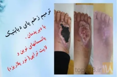 نمونه کار مرکز  زخم دکتر قادری تبریز در تبریز - 6