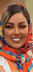 نمونه کار دندانپزشکی  دکتر سید  ابراهیم تقوی در تبریز - 6