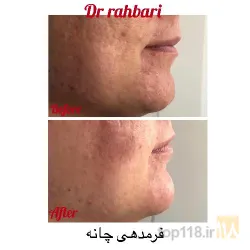 نمونه کار زیبایی و پوست و مو دکتر رسول رهبری در تبریز - 6
