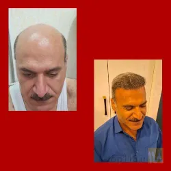 نمونه کار کلینیک تخصصی پوست و مو یاقوت در تبریز - 6
