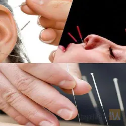 نمونه کار کایروپراکتیک و طب سنتی در تبریز - 5