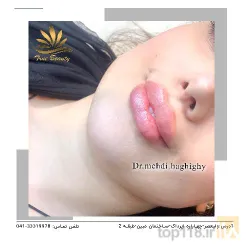 نمونه کار کلنیک زیبایی پوست و مو دکتر حقیقی در تبریز - 6
