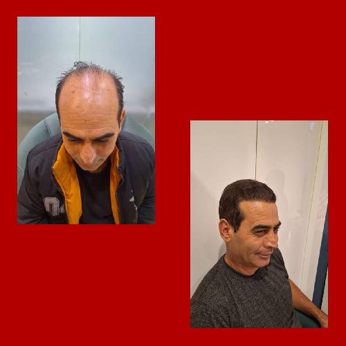 پوست و مو و زیبایی در تبریز